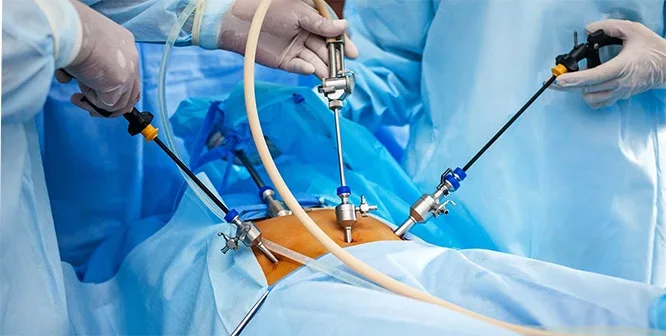 Metabolik Cerrahi ile Diyabete Yeni Bir Bakış